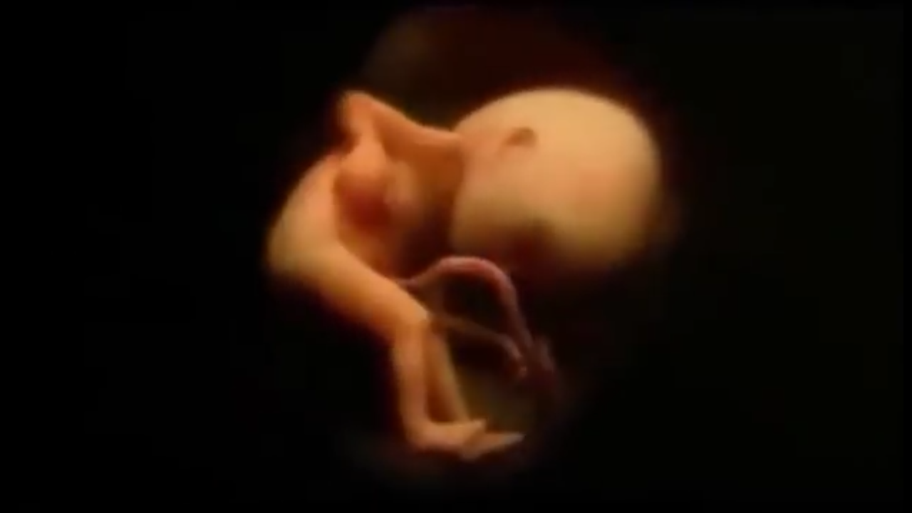 foto de un feto